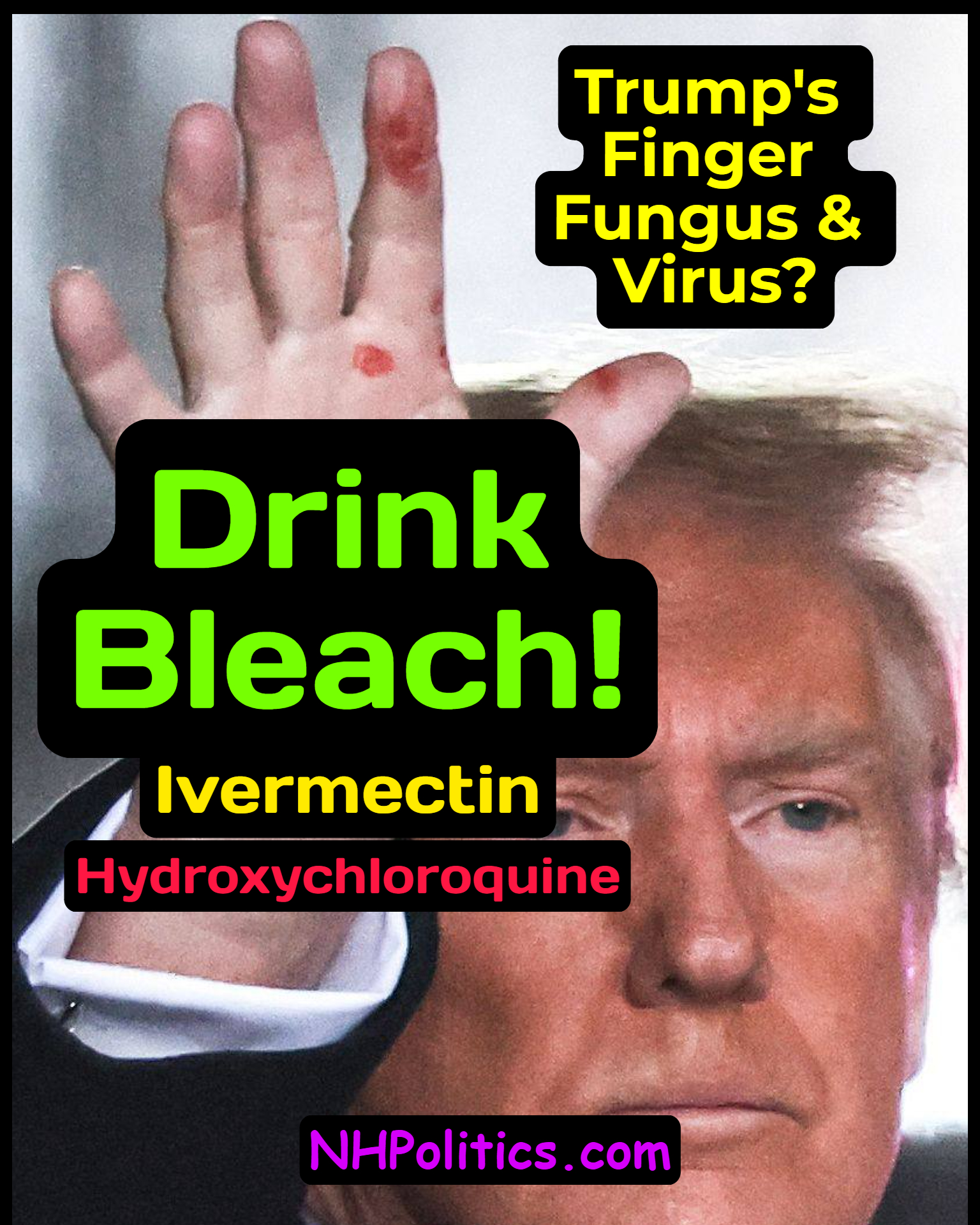 Trump Finger Fungus